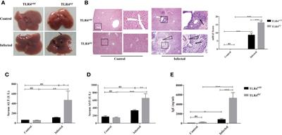 TLR4 Deficiency Exacerbates Biliary Injuries and Peribiliary Fibrosis Caused by Clonorchis sinensis in a Resistant Mouse Strain